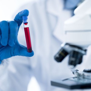 Most Reliable Blood Test in Kathmandu – Central Diagnostic Lab